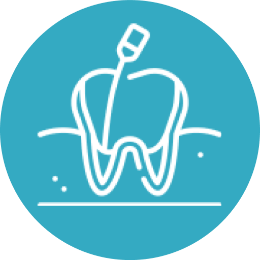 Root Canal Treatment