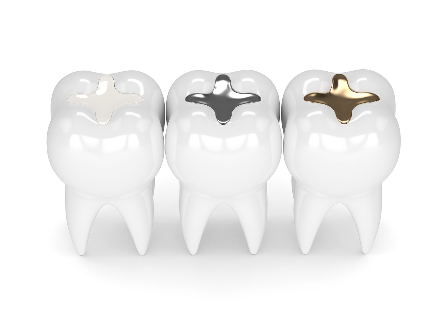 Tooth Coloured Fillings Tooth Coloured Fillings